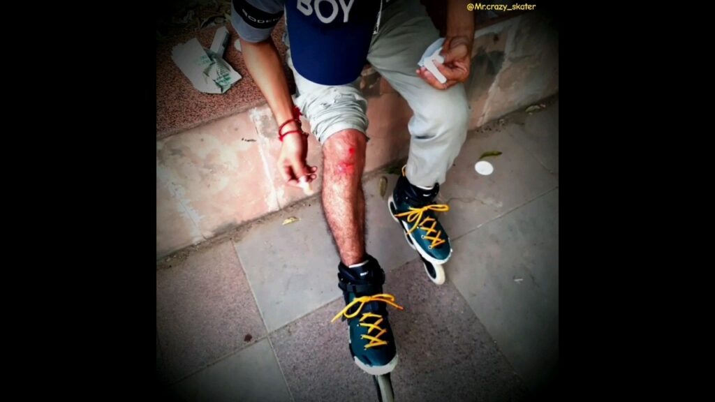 skating Exidant pain 🤒 || skating reod Exidant 🚫⚠️ #shorts #skating #skater #pain