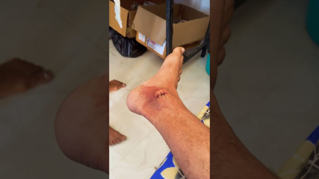 मेरा Leg 🦵 Inline Skate nhi pahan payega 😞 #skaterboy #minivlog #vishalskater #skatevlogger #skate