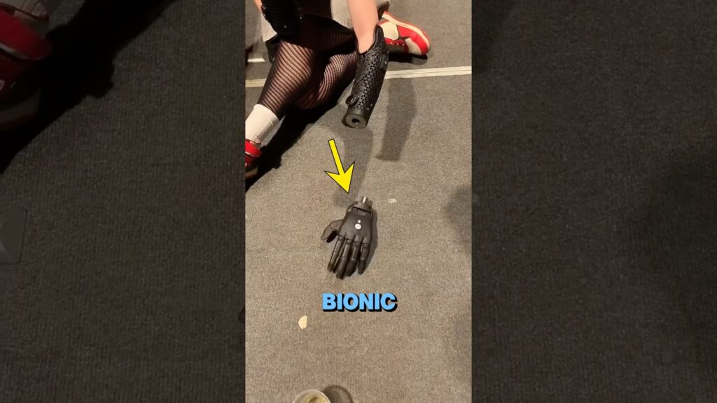 Bionic Arm That Works Wirelessly