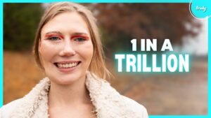 A Dentist Drilled My Tooth – Now I’m 1 In A Trillion | BORN DIFFERENT